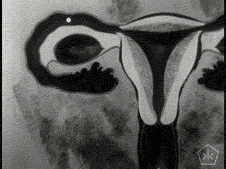 ¿Puede quedar embarazada una mujer durante la menstruación? 3 giphy 3