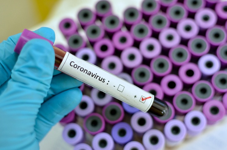 COBERTURA ESPECIAL: Noticias verificadas sobre el Coronavirus 4 COBERTURA ESPECIAL: Noticias verificadas sobre el Coronavirus