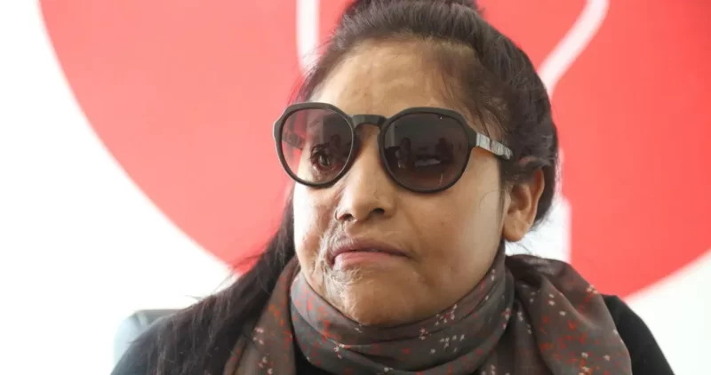 Carmen Sanchéz acido