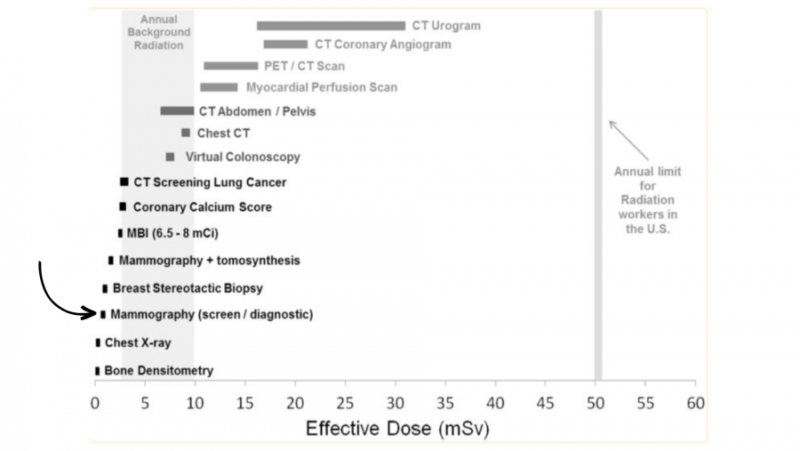 Comparación entre la radiación de una mamografía y otros procedimientos médicos