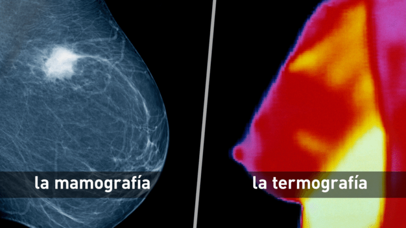Diferencia entre unas mamografías y unas termografías