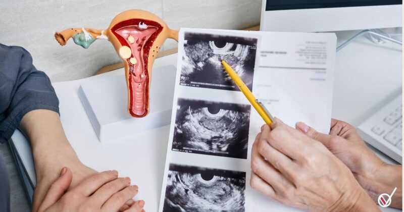 Síndrome de Ovario Metabólico Poliendocrino (PMOS)