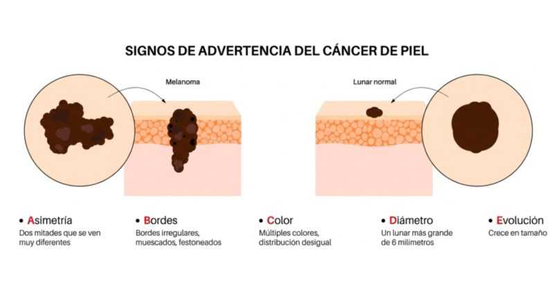 Engañoso que los tatuajes causan cáncer de piel 2 Copia LILA PORTADAS NUEVAS 49